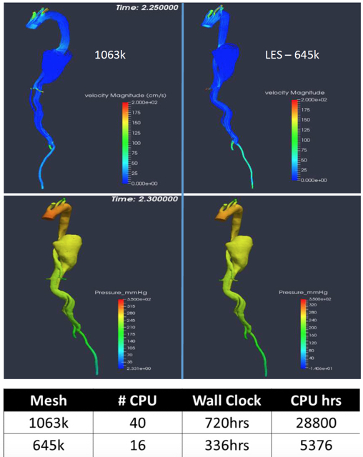 Comparison of velocity, pressure, and computational time for a DNS and a LES approach in a patient-specific geometry. 
