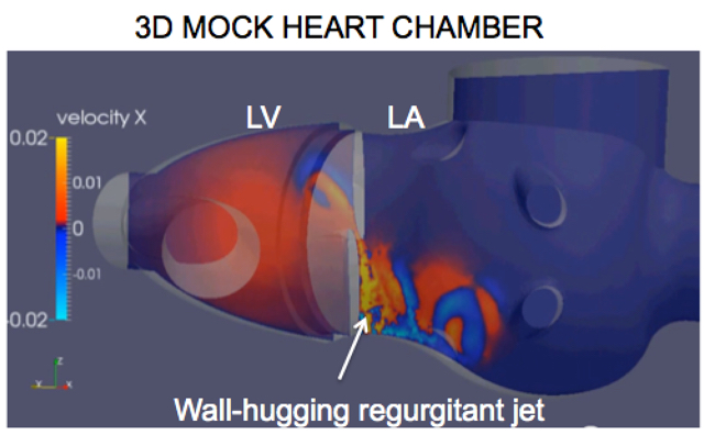 Simulation of regurgitant flow in a realistic mock heart chamber at Reynolds number 3000.